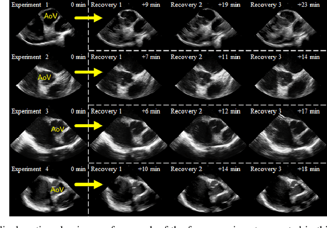 Figure 4 for Automated Catheter Tip Repositioning for Intra-cardiac Echocardiography
