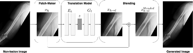 Figure 1 for Generative Image Translation for Data Augmentation of Bone Lesion Pathology