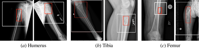 Figure 2 for Generative Image Translation for Data Augmentation of Bone Lesion Pathology