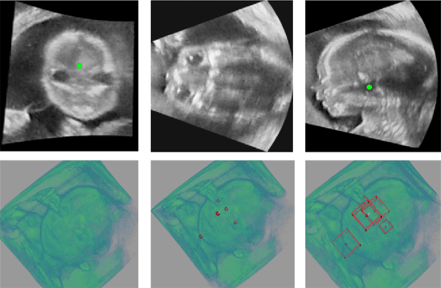 Figure 1 for Region Proposal Network with Graph Prior and IoU-Balance Loss for Landmark Detection in 3D Ultrasound