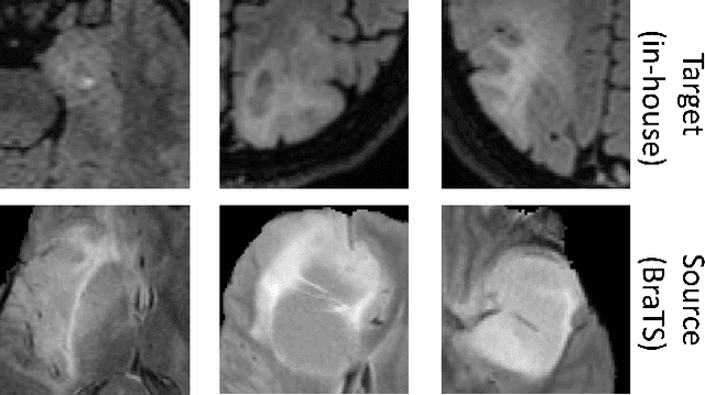 Figure 1 for Towards continuous learning for glioma segmentation with elastic weight consolidation