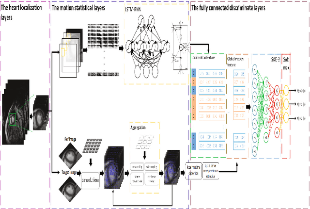 Figure 1 for Direct detection of pixel-level myocardial infarction areas via a deep-learning algorithm