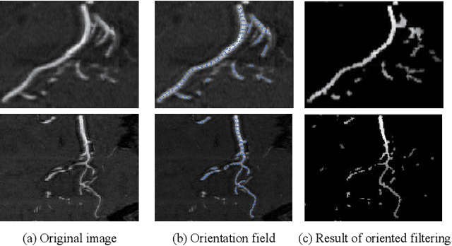 Figure 3 for Cerebrovascular Segmentation via Vessel Oriented Filtering Network