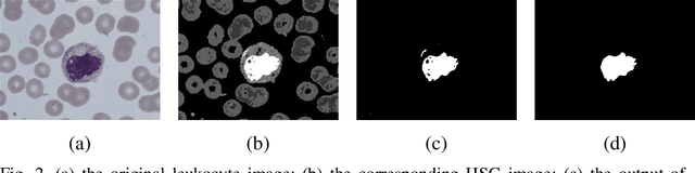 Figure 3 for A novel algorithm for segmentation of leukocytes in peripheral blood