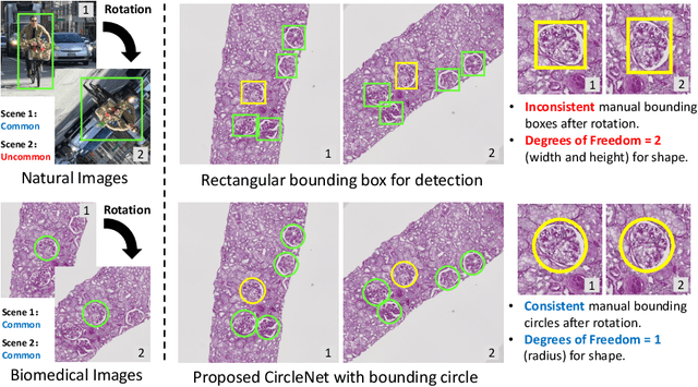 Figure 1 for CircleNet: Anchor-free Detection with Circle Representation