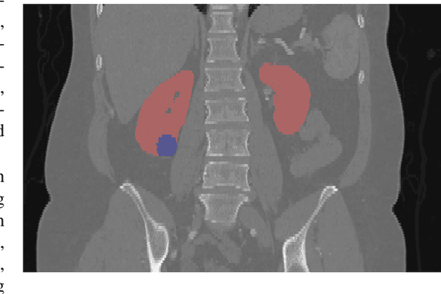 Figure 1 for The state of the art in kidney and kidney tumor segmentation in contrast-enhanced CT imaging: Results of the KiTS19 Challenge