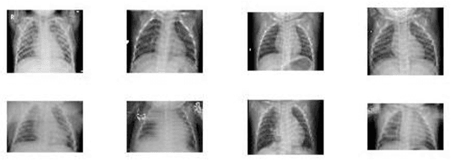 Figure 1 for A Critic Evaluation of Methods for COVID-19 Automatic Detection from X-Ray Images