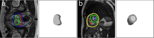 Figure 3 for Learning to Segment Medical Images with Scribble-Supervision Alone