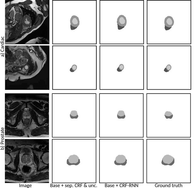 Figure 4 for Learning to Segment Medical Images with Scribble-Supervision Alone