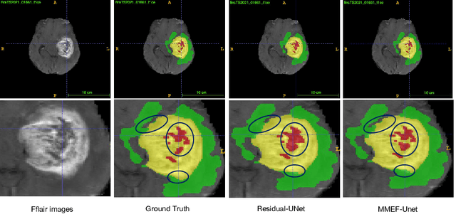 Figure 4 for Evidence fusion with contextual discounting for multi-modality medical image segmentation
