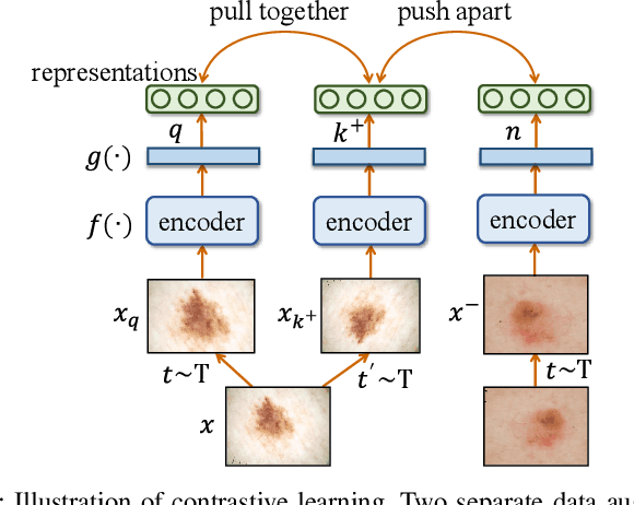 Figure 1 for Federated Self-Supervised Contrastive Learning and Masked Autoencoder for Dermatological Disease Diagnosis