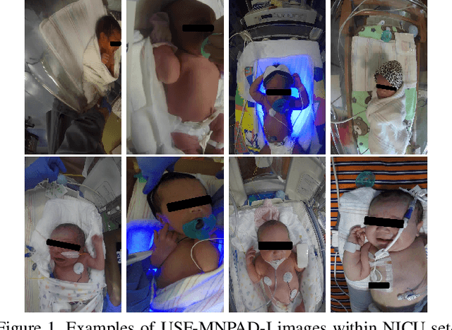 Figure 1 for Robust Neonatal Face Detection in Real-world Clinical Settings