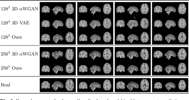 Figure 3 for Modelling the Distribution of 3D Brain MRI using a 2D Slice VAE