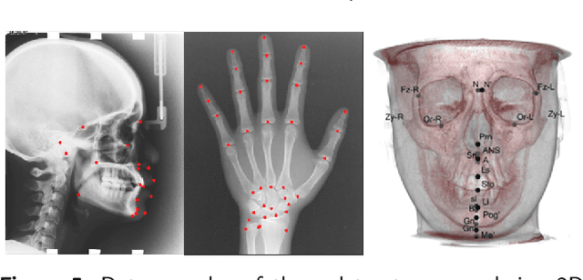 Figure 2 for Semi-supervised Anatomical Landmark Detection via Shape-regulated Self-training