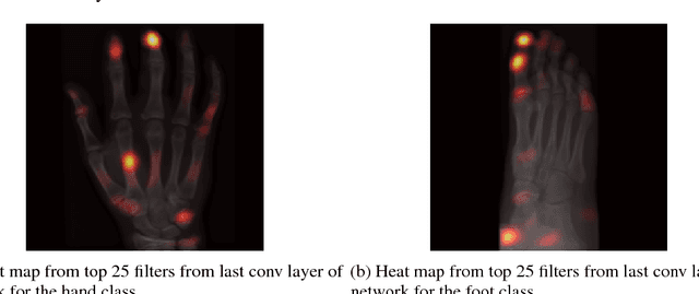 Figure 3 for Understanding Anatomy Classification Through Attentive Response Maps