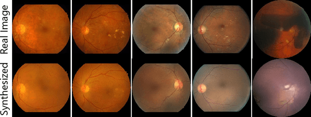 Figure 4 for Explainable Diabetic Retinopathy Detection and Retinal Image Generation