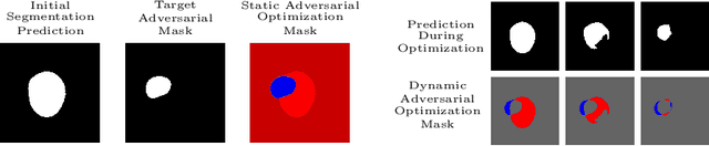 Figure 3 for Impact of Adversarial Examples on Deep Learning Models for Biomedical Image Segmentation