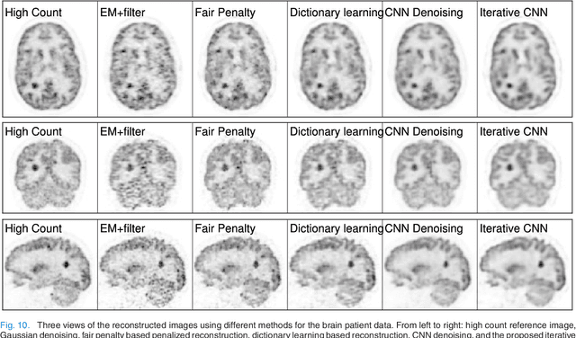 Figure 2 for Iterative PET Image Reconstruction Using Convolutional Neural Network Representation