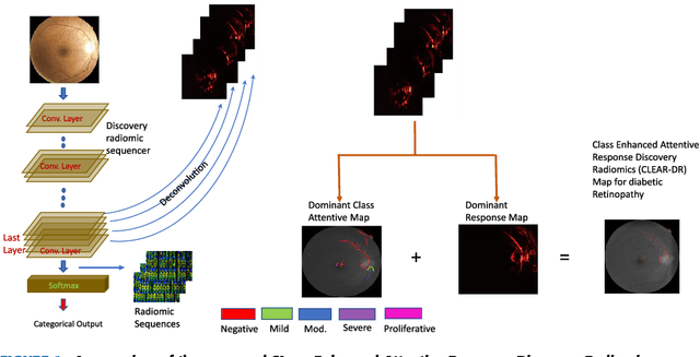 Figure 1 for Discovery Radiomics with CLEAR-DR: Interpretable Computer Aided Diagnosis of Diabetic Retinopathy