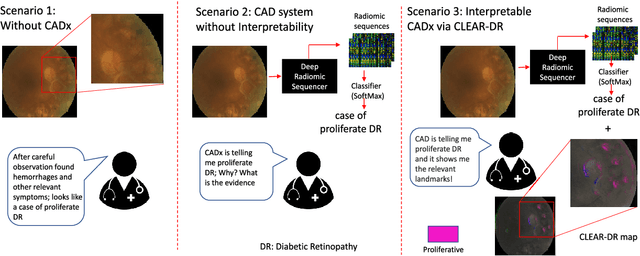 Figure 2 for Discovery Radiomics with CLEAR-DR: Interpretable Computer Aided Diagnosis of Diabetic Retinopathy