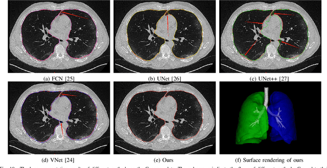 Figure 2 for COVID-19 Chest CT Image Segmentation -- A Deep Convolutional Neural Network Solution