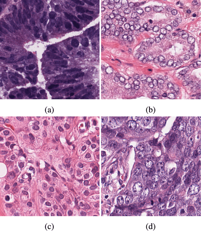 Figure 1 for A Deep Learning Algorithm for One-step Contour Aware Nuclei Segmentation of Histopathological Images