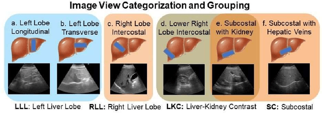 Figure 2 for Accurate and Generalizable Quantitative Scoring of Liver Steatosis from Ultrasound Images via Scalable Deep Learning