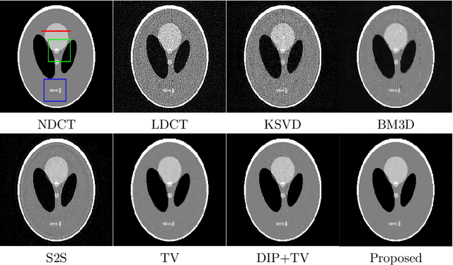 Figure 3 for Dataset-free Deep learning Method for Low-Dose CT Image Reconstruction