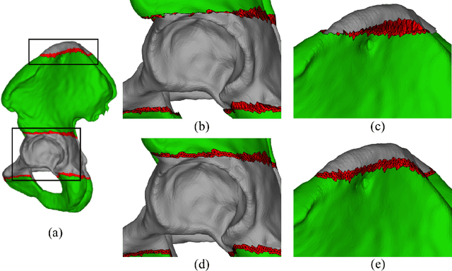 Figure 1 for Pelvis Surface Estimation From Partial CT for Computer-Aided Pelvic Osteotomies