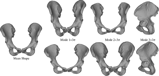 Figure 2 for Pelvis Surface Estimation From Partial CT for Computer-Aided Pelvic Osteotomies