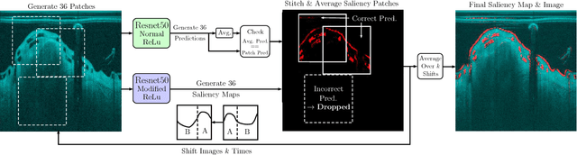 Figure 1 for Bioresorbable Scaffold Visualization in IVOCT Images Using CNNs and Weakly Supervised Localization