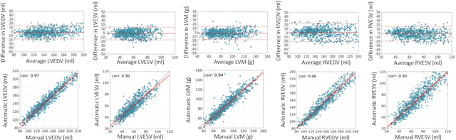 Figure 4 for High Throughput Computation of Reference Ranges of Biventricular Cardiac Function on the UK Biobank Population Cohort