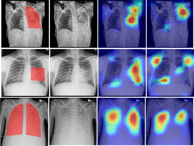 Figure 4 for Learning Invariant Feature Representation to Improve Generalization across Chest X-ray Datasets
