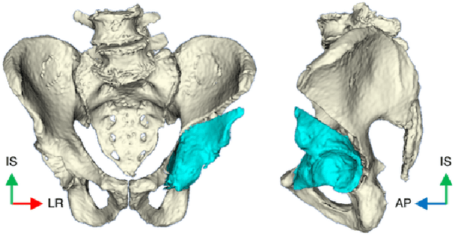 Figure 1 for Pose Estimation of Periacetabular Osteotomy Fragments with Intraoperative X-Ray Navigation