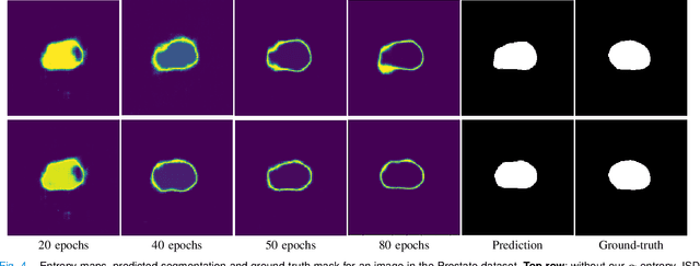 Figure 4 for Self-paced and self-consistent co-training for semi-supervised image segmentation