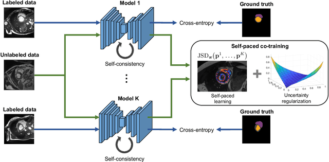 Figure 1 for Self-paced and self-consistent co-training for semi-supervised image segmentation