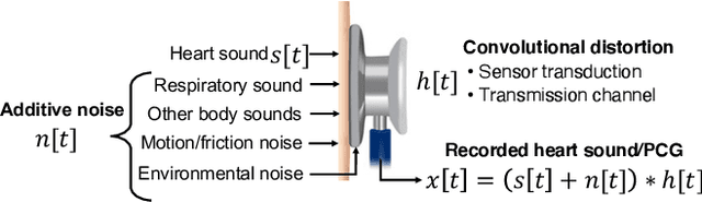 Figure 1 for Heart Sound Classification Considering Additive Noise and Convolutional Distortion