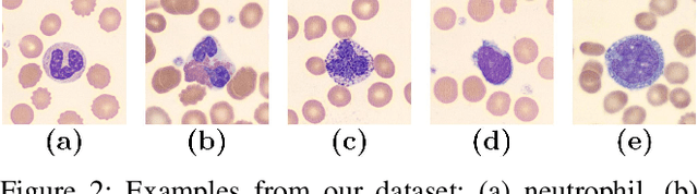Figure 3 for W-Net: A CNN-based Architecture for White Blood Cells Image Classification