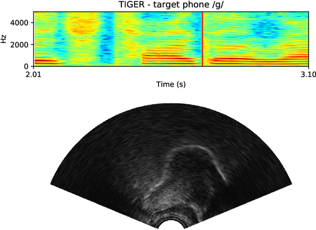 Figure 3 for Exploiting ultrasound tongue imaging for the automatic detection of speech articulation errors