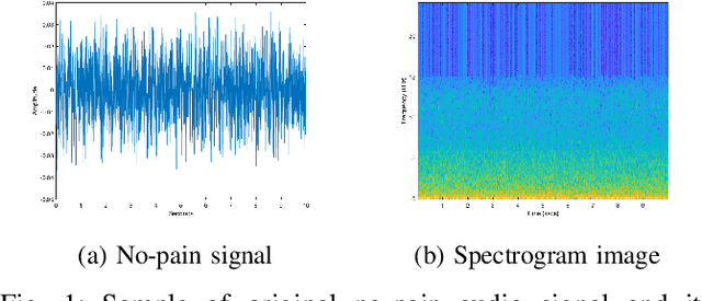 Figure 1 for Harnessing the Power of Deep Learning Methods in Healthcare: Neonatal Pain Assessment from Crying Sound