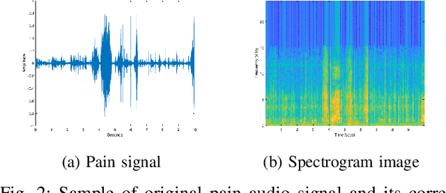 Figure 2 for Harnessing the Power of Deep Learning Methods in Healthcare: Neonatal Pain Assessment from Crying Sound
