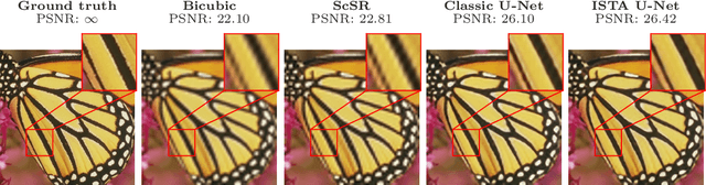 Figure 4 for Interpreting U-Nets via Task-Driven Multiscale Dictionary Learning