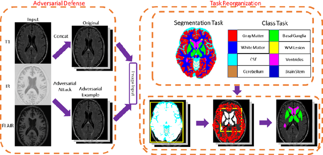Figure 1 for Brain MR Image Segmentation in Small Dataset with Adversarial Defense and Task Reorganization