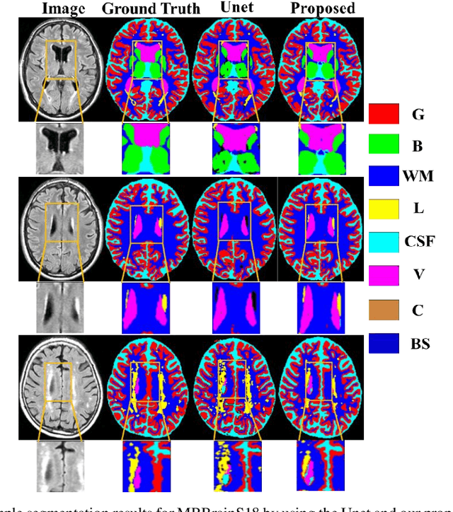 Figure 3 for Brain MR Image Segmentation in Small Dataset with Adversarial Defense and Task Reorganization