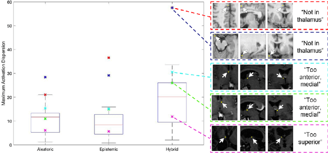 Figure 3 for Uncertainty Estimation in Medical Image Localization: Towards Robust Anterior Thalamus Targeting for Deep Brain Stimulation