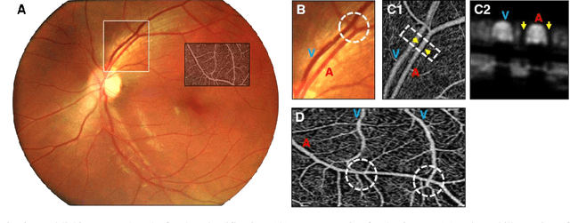 Figure 2 for Depth-resolved vascular profile features for artery-vein classification in OCT and OCT angiography of human retina
