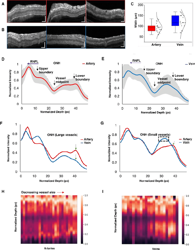 Figure 3 for Depth-resolved vascular profile features for artery-vein classification in OCT and OCT angiography of human retina