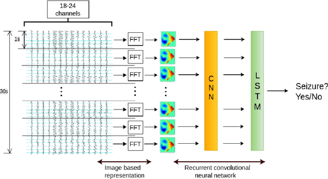 Figure 1 for Learning Robust Features using Deep Learning for Automatic Seizure Detection