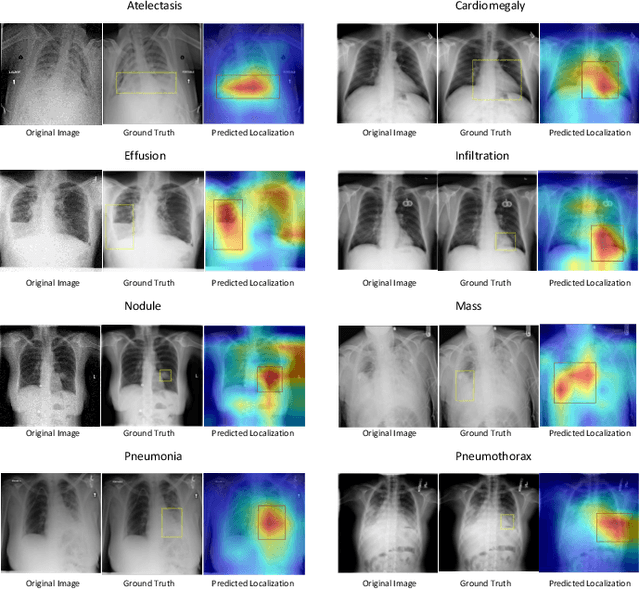 Figure 3 for SCALP -- Supervised Contrastive Learning for Cardiopulmonary Disease Classification and Localization in Chest X-rays using Patient Metadata