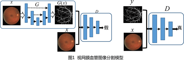 Figure 1 for Retinal Vessel Segmentation Based on Conditional Deep Convolutional Generative Adversarial Networks